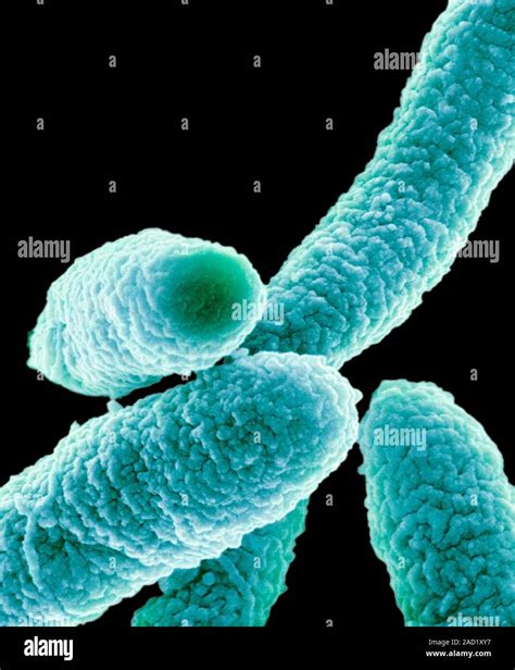 Coloured Scanning Electron Micrograph Sem Of Escherichia Coli Bacteria E Coli Are Gram