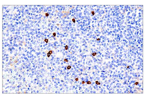 Il3racd123 Br4ms Mouse Mab Cell Signaling Technology