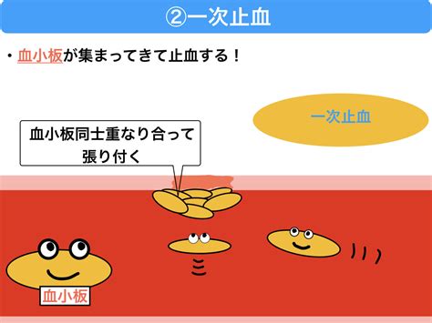 播種性血管内凝固症候群 DIC とは病態や症状をわかりやすくイラストで解説