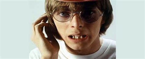 David Bowie's teeth | The London Lingual Orthodontic Clinic