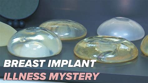 Surgeon Breast Implant Illness A Mystery Youtube