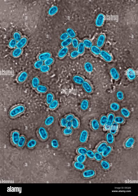 Streptococcus Pneumoniae Microscopio Fotograf As E Im Genes De Alta