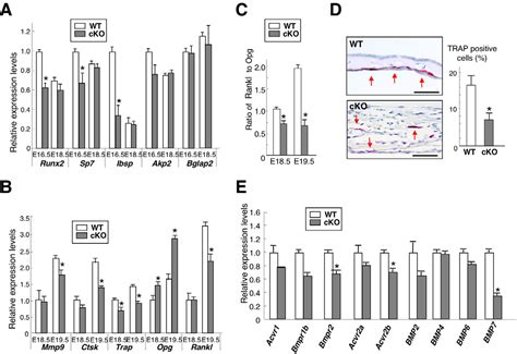 Figure 3 From BMP Signaling Negatively Regulates Bone Mass Through