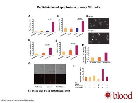 Induction Of Ca2 Driven Apoptosis In Chronic Lymphocytic Leukemia