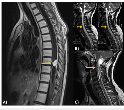 Image Based Differential Diagnosis A Magnetic Resonance Imaging T1