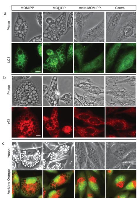 Figure 1 From Defining The Mechanism Of Methuosis A Non Apoptotic Cell