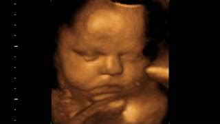 What Is A D Ultrasound Scan Importance And How It Works Off