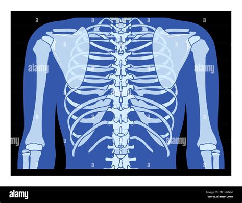 Caja Torácica De Rayos X Y Manos Esqueleto Huesos Del Cuerpo Humano Adultos Roentgen Vista