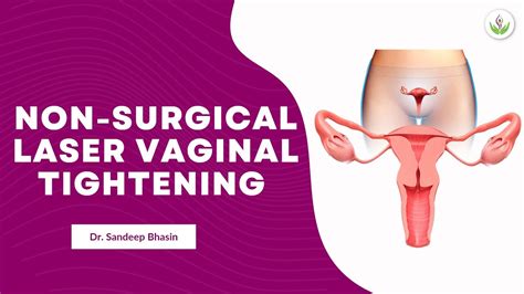 Non Surgical Laser Vaginal Tightening Rejuvenation Treatment Care Well Medical Centre Youtube