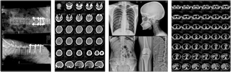 Laser Medical X Ray Films Microns