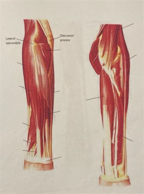 Solved Triceps Medial Epicondyle Olecranon Process Flexor