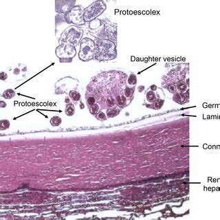 microscopy  hydatid cyst structure  scientific diagram