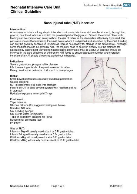 Naso Jejunal Tube Insertion