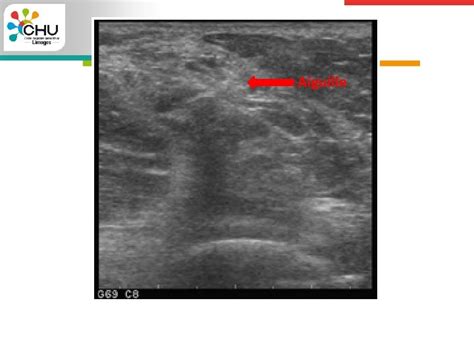 Echographie Pour Le Clinicien Partie Intgrante De Lexamen