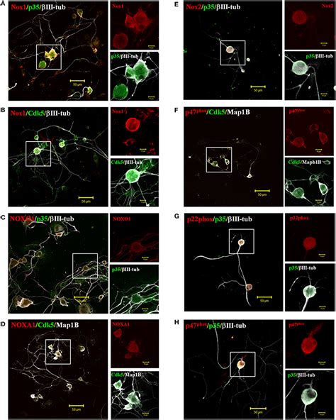 Frontiers TNF α Increases Production of Reactive Oxygen Species