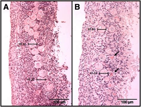 Histological Sections Of Ovarian Cortex From The Domestic Cat Before A