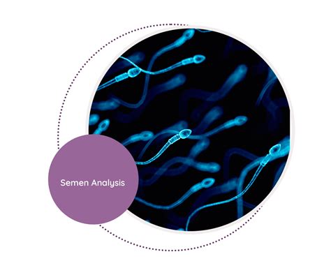 Semen Analysis Mediscan Lab