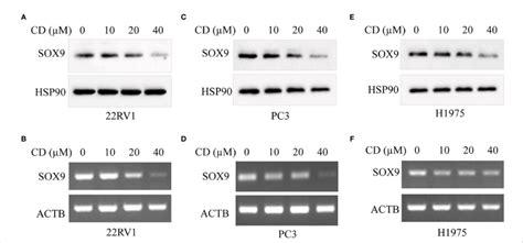 CD inhibits the expression of SOX9 in different tumor cells. (A ... 