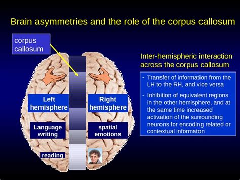 Cerebral Asymmetry And The Specific Functions Of The