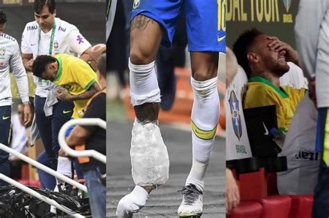 Fotos Así Fue El Drama Que Vivió Neymar Tras Su Ruptura De Ligamentos En El Tobillo