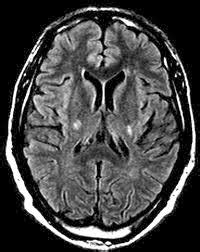 Medical Treatment Pictures-for Better Understanding: Primary Lateral ...