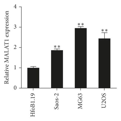 A Long Noncoding Rna Metastasis Associated Lung Adenocarcinoma