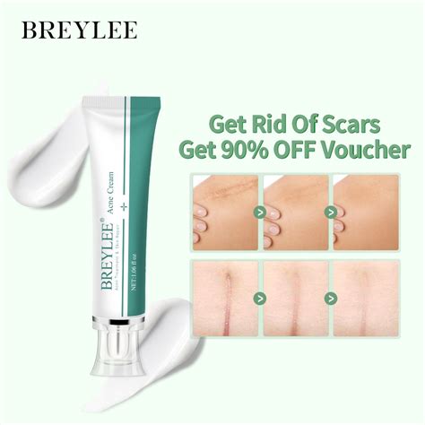 BREYLEE Scar Removal Gel 30g Skin Repair Scar Acne Treatment Remove