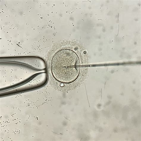 Assisted Hatching Implantación Asistida