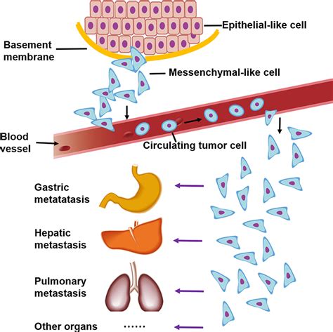 Epithelial Mesenchymal Transition And Its Regulation In Tumor