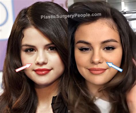 Selena Gomez: BEFORE and AFTER 2022