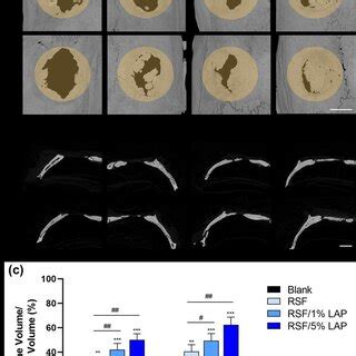 Micro Ct Image Analysis Of New Bone Formation In A Rat Calvarium Model