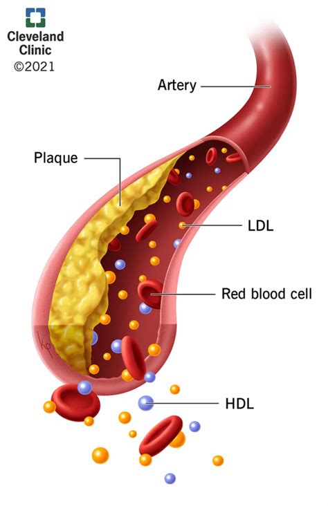 Do Sarms Increase Blood Pressure Sarms Side Effects