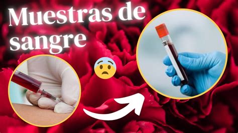 Como Tomar Muestras De Laboratorio T Cnica De Enfermer A Youtube