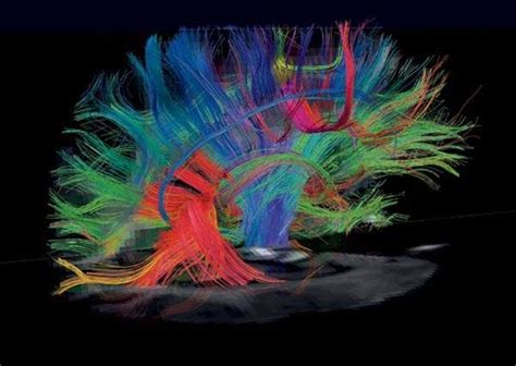 DTI Information for Providers | University Medical Imaging