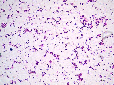 Listeria Gram Stain - Gram Stains