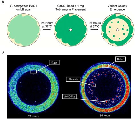 Isolation Of P Aeruginosa Colony Variants For Assaying The Genome And