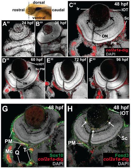 JDB Free Full Text Zebrafish Model Of Stickler Syndrome Suggests A