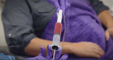 Administering an IV Push | EQUASHIELD Educational Video