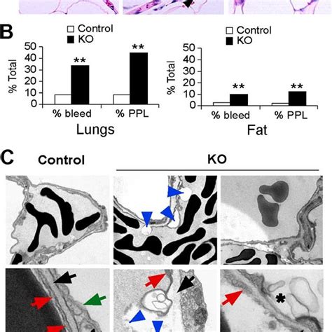 Hif 2 Deletion Affects Lung Endothelial Cells And Capillaries A H E