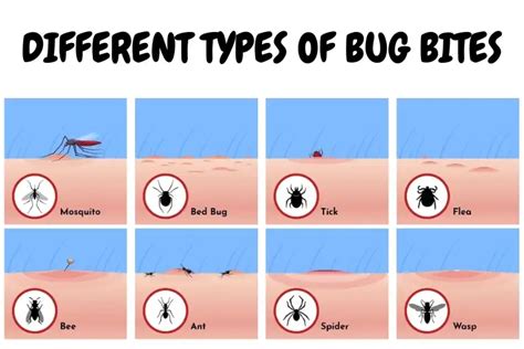 Different Types Of Bug Bites And How To Treat Them