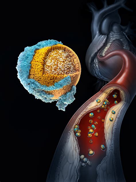 Nih Research Reveals New Insights About How Bad Cholesterol Works In