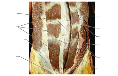 Muscles of Abdominal Wall Diagram | Quizlet