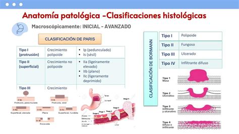 CÁNCER GÁSTRICO Paulina Cucalon uDocz