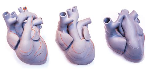 46a To C Fetal Heart 3d Models As A Result Of 3d Printing Left Normal