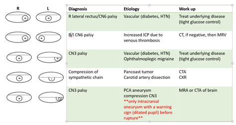 Ophthalmoplegic migraine – 9/25/18 | SCVMC IM Chief Resident Blog