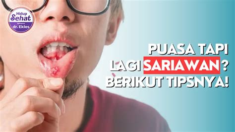 Wajib Tahu Inilah Tips Penting Atasi Sariawan Saat Puasa Youtube