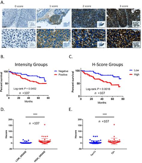 Elevated Expression Levels Of LRRC59 Were Revealed As Clinically