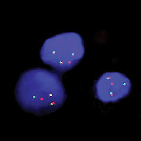 Fluorescent In Situ Hybridization Dual Color Dual Fusion Two Download Scientific Diagram