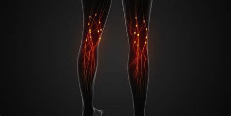 Femoral Nerve Pain Causes And Treatment Walk Without Pain