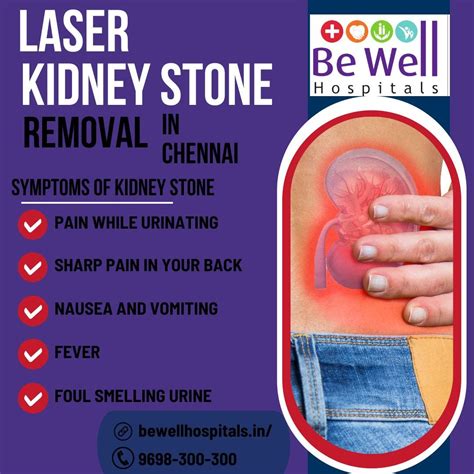 Laser Kidney Stone Removal in Chennai - Be Well Hospitals - Medium